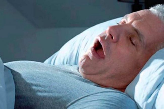apnea obstructiva del sueño apnea obstructiva del sueño