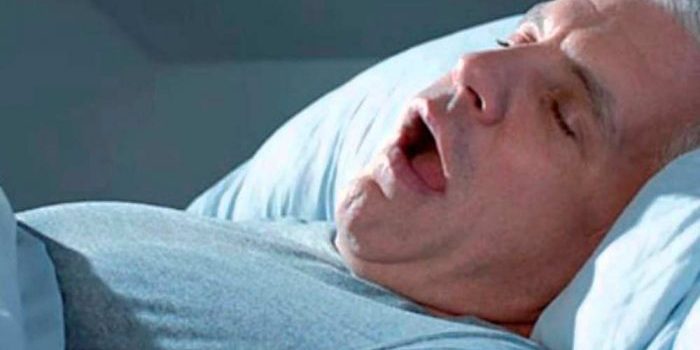 apnea obstructiva del sueño apnea obstructiva del sueño
